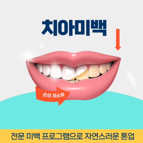세종치과 세종특별자치시 치과 치아미백